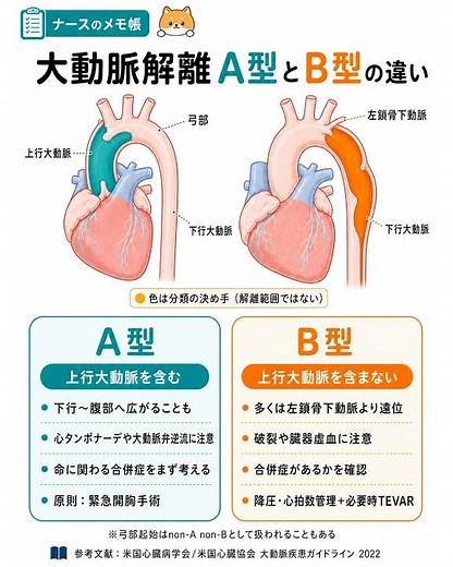 【看護師・看護学生向け】大動脈解離A型とB型の違い