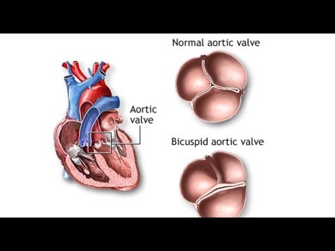 Congenital Anomalies|| Part 3|| Birth defects|| Newborn..