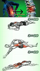 130K views · 1.3K reactions | herniated disc #BackPainRelief #workout #fitness #gym #HerniatedDiscExercises | Fit-workout body | Facebook