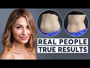 CoolSculpting & EmSculpt | Real People, True Results