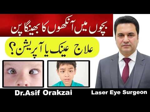 Squint Eye Problem | Reasons, Symptoms & Best Treatment Solutions