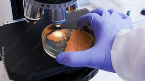 Microscopy of yeast colonies. A scientist puts a Petri dish with yeast bacteria under a microscope.