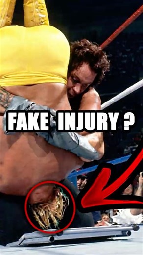Did Hulk Hogan FAKE His Injury vs The Undertaker? 😳