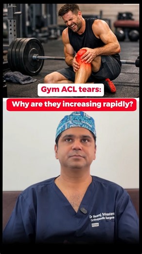 GYM ACL Tears: Why are they increasing rapidly ? | Dr Neeraj Srivastava