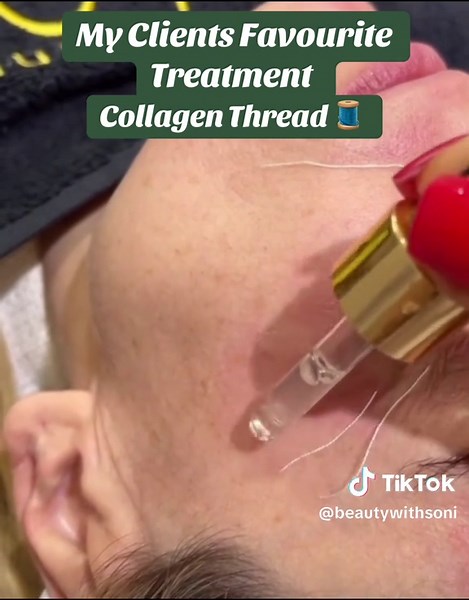 How to Apply Collagen Thread for Youthful Skin