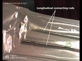 Lumbar Dynamic Arthrodesis Surgery - Posterior Lateral Approach • Video • MEDtube.net