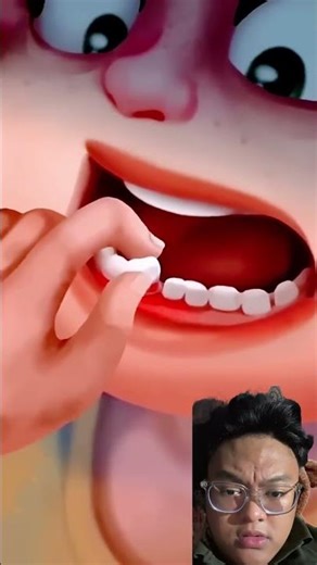 Loose tooth about to fall out‼️sc:@YoYa_oLiVia #shortsvideo #funny #comedy