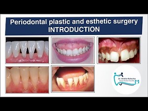 PERIODONTAL PLASTIC AND ESTHETIC SURGERY/INTRODUCTION/TERMINOLOGIES/OBJECTIVES/DR. ANKITA KOTECHA