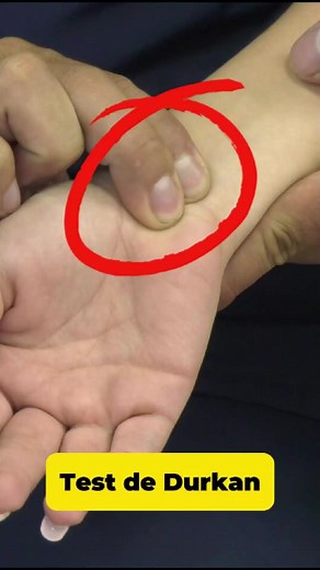 11K views · 224 reactions | El test de Durkan es una prueba que...