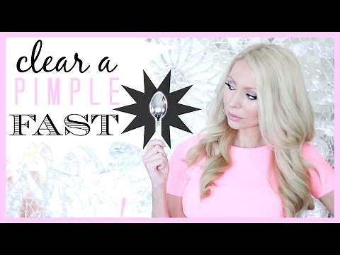 How To Clear Pimples Fast - Amazing Trick!