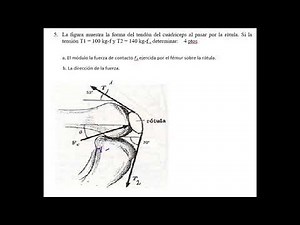 La figura muestra la forma del tendón del cuádriceps al pasar por la rótula. Si la tensión T1 = 100