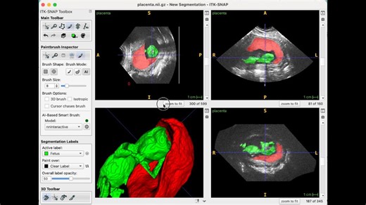 Demo of new Deep Learning Segmentation in ITK-SNAP 4.4