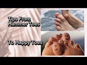 How to Promote Healing Hammer Toes | Acupressure & Exercises