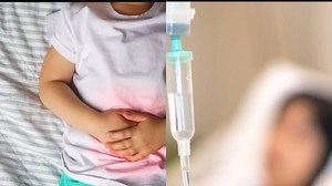 Apendicitis en niños: ¿qué es y cómo pueden los padres detectar los síntomas?