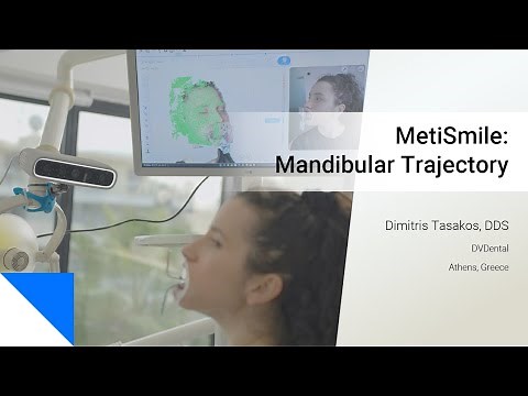 New Jaw Motion Features inside MetiSmile