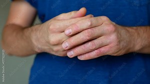 The man has psoriasis. The man is nervous and scratches his hands.