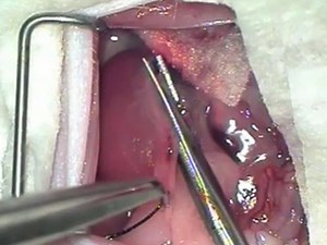 Renal Ischaemia Reperfusion Injury: A Mouse Model of Injury and Regeneration