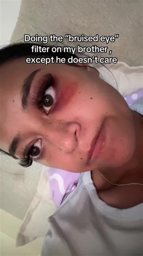 Bruised Eye Filter Pranks: Creative Ideas and Tips