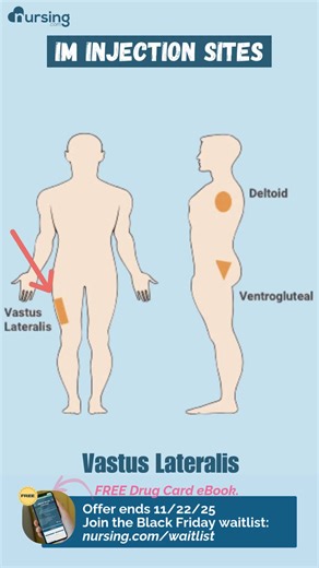 💉 4 IM Injection Sites You Gotta Know Let’s break it down: ❌ Dorsogluteal — almost never used (sciatic nerve risk 🚫) ✅ Vastus Lateralis — middle 1/3 of outer thigh ✅ Ventrogluteal — outer hip (safe reliable) ✅ Deltoid — upper arm (smaller volumes only) 💡 Pro Tip: Always double check landmarks. Your patients (and your grade) will thank you. 🎁 Join the Black Friday waitlist get a FREE Drug Card eBook! → nursing.com/waitlist Link in bio 🖤 #IMInjectionSites #NursingSchoolTips #BlackFridayNursin