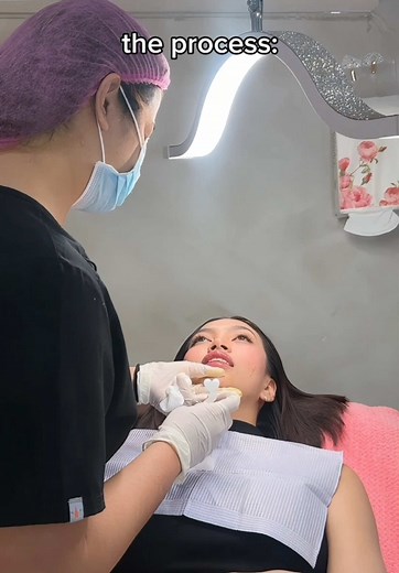 Chin Fillers Results: Before and After Transformation