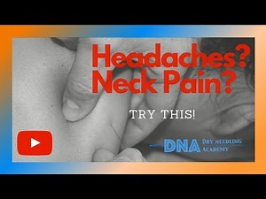 Dry Needling the Posterior Trapezius muscle