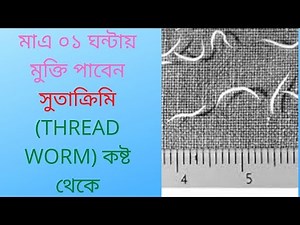 মাএ ০১ ঘন্টায় মুক্তি পাবেন সুতাক্রিমি (THREAD WORM) কষ্ট থেকে-Dr.Delwar hossain