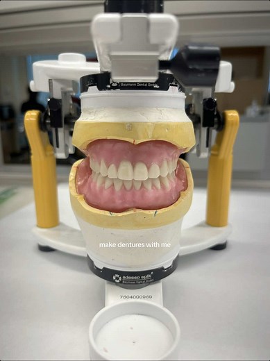 Dental School Insights: Making Dentures Explained