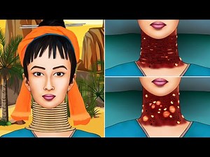 ASMR Treatment & Removal of Maggots From Infected Neck | Severely Injured Animation | Beauty ASMR