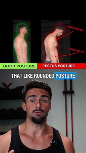 Do This Stretching Regime to Fix Pectus Posture