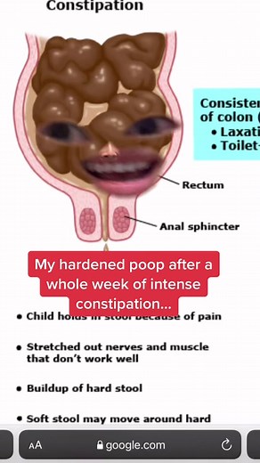 Understanding Chronic Constipation: Symptoms, Causes, and Remedies