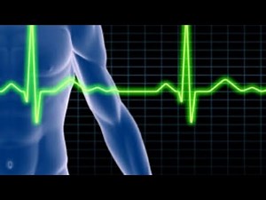 Left Anterior Fascicular Block