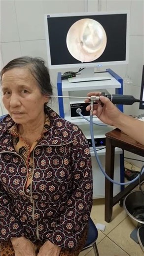 Nhện trong tai bà - Spiderman in ear #asrm #foreignbody #bshoangthach #Pktaimuihong03leninh