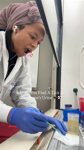 Marilyn | CLS MLS(ASCP) on Instagram: "Never in my life did I think I’d find THIS in a urine sample. Especially not at the end of a 17 hour shift. 💀🐜 Comment the word PASS to pass the ASCP Exam with me. 🔬🧪"
