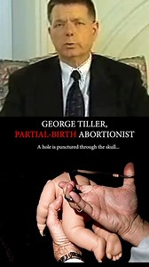 George Tiller killed over 60,000 preborn babies — many in late-term abortions between 24–36 weeks. He admitted to committing illegal partial-birth abortions: delivering a child breech, then killing them before the head emerged. He called these fully formed, viable babies “the problem.” This dehumanization and violence still happens today. Abortion must end. | Live Action