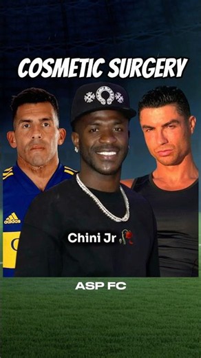 I added players who had Cosmetic Surgery to FC 26!
