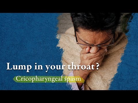 Cricopharyngeal Spasm: A Troubling Feeling of a Lump in the Throat