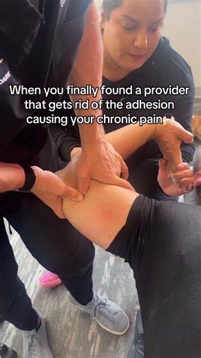Sick and tired of that chronic pain & tightness?😖 Using adhesion release methods, our office provides lasting results for our patients.👇🏻 Even when they have tried chiropractic, acupuncture, PT, cupping, dry needling, etc.. & nothing seems to be giving them lasting results.. Sound like you?🤯 Other providers tend to miss a key component. 👉🏻Adhesion. ‼️‼️ One of the common under-diagnosed cause of chronic pain. And it’s fixable🎉😁 We do this using a specific kind of manual therapy that you 