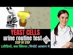 Yeast Cell in Urine Report | Candida Infection | UTI | Microscopy | urine routine | Patho Point