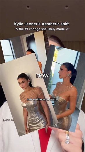 Mona Seresht, PA-C, MSPAS | LA Injector + Skincare on Instagram: "Your favorite celebrities aren’t looking better because they’re getting less work done, they’re just getting better work. The trend towards undetectable work is an exciting hot topic, but it’s also a return to the core principles of what injectables were originally designed to do. Injectables like Botox/Dysport and filler may have gotten a bad rap in the past, but they were always intended to create subtle, natural results. The go