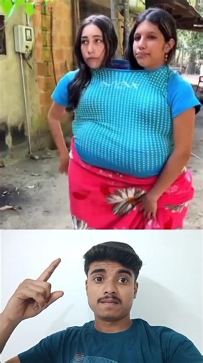 Faded song | conjoined woman #disabled #shorts #viral