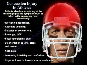 Concussion In Athletes - Everything You Need To Know - Dr. Nabil Ebraheim
