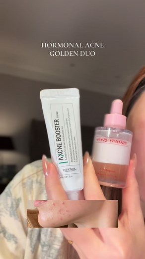 66K views · 333 reactions | The hormonal acne golden duo…  #kbeauty #koreanskincare #skincare #texturedskin #acne #hormonalacne #acnetriggers #skincare101 | Song Of Skin | Facebook