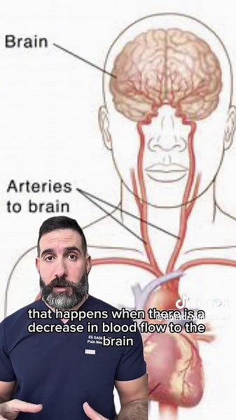 convulsive syncope experiment from 1994 on medical students #seizure #syncope #fainting #passingout Convulsive syncope and epileptic seizure are both causes of transient loss of consciousness with abnormal movements, but they differ in pathophysiology, clinical features, and post-event recovery.