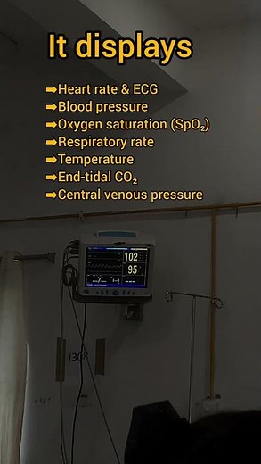 Ever wondered what those ICU monitors really show?