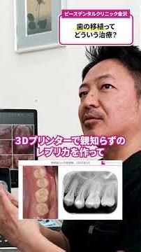 歯の移植ってどういう治療？ #金沢歯医者 #ピースデンタルクリニック #歯の移植 #自家歯牙移植 #歯を残す治療