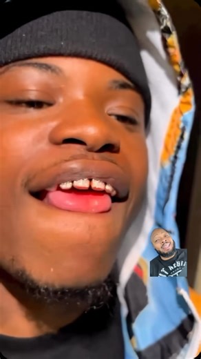 Alfred “Fredo” Thomas III on Instagram: "Just rock the pearly whites fam 🤦🏾‍♂️ Subscribe to my YouTube with the link in my bio 🤙🏾 #fredotv #funny #comedy #jokes #reels #reaction #relatable"