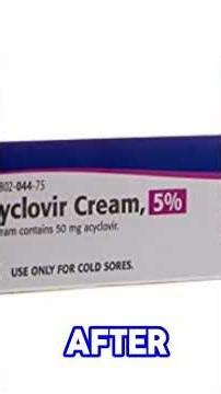 Uses of Acyclovir Cream