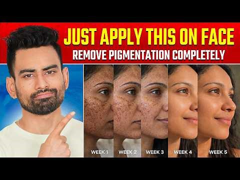 सिर्फ 7 दिन में कितनी भी पुरानी झाइयां, काले दाग धब्बे 100% जड़ से खत्म करें | Fit Tuber