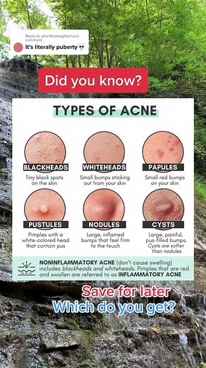 Different Types of Acne During Puberty