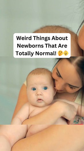 15 Weird Things About Newborns That Are Totally Normal! 🤔👶 Becoming a parent means discovering just how fascinating (and strange) newborns can be. Here are 15 "weird" things about babies that are completely normal: 1️⃣ Crossed Eyes: Those wandering eyes? 👀 Totally fine—their eye muscles are still in training! 2️⃣ Flaky Skin: They’re just shedding their "womb skin" like a little snake 🐍. 3️⃣ Cone-Shaped Head: Passing through the birth canal works wonders on their noggin 🌀—it’ll round out soo
